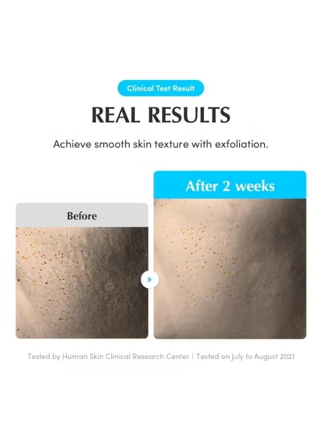 eqqualberry Swimming Pool Toner - Gentle Exfoliating Toner with Natural Enzyme | Boosted Hydration with Hyaluronic Acid | Daily Toner for Sensitive Skin | Korean Skincare, 10.14 Fl. Oz / 300ml - Image 3